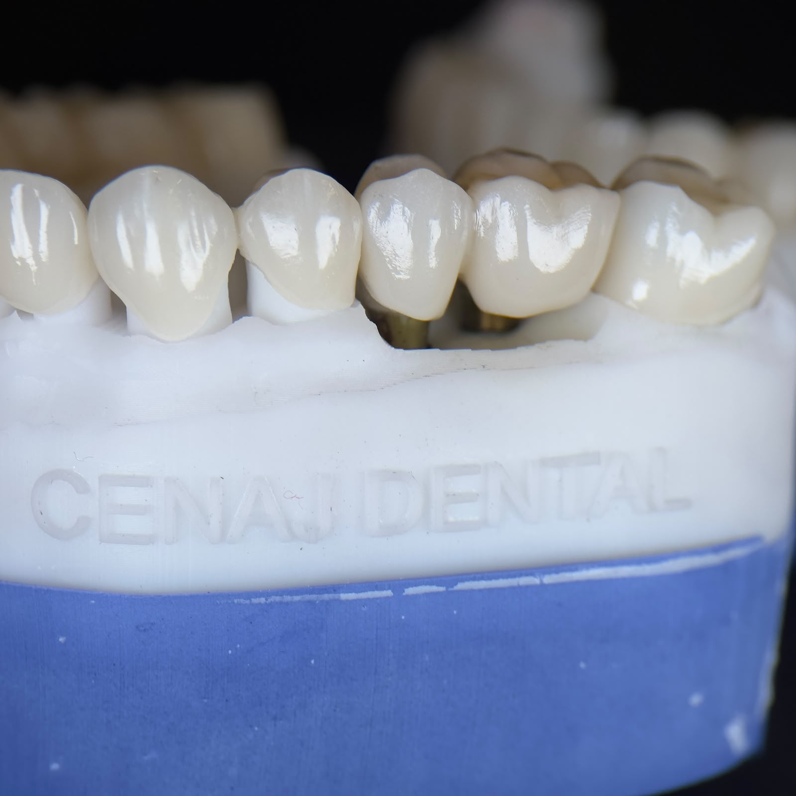 Cenaj Dental Foto 4